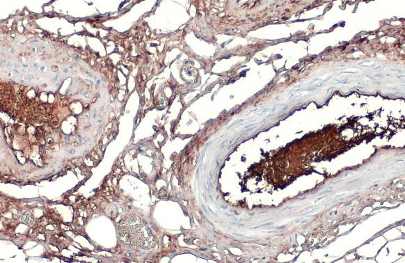 ApoA1 Antibody in Immunohistochemistry (Paraffin) (IHC (P))