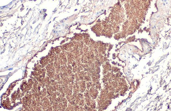 ApoA1 Antibody in Immunohistochemistry (Paraffin) (IHC (P))