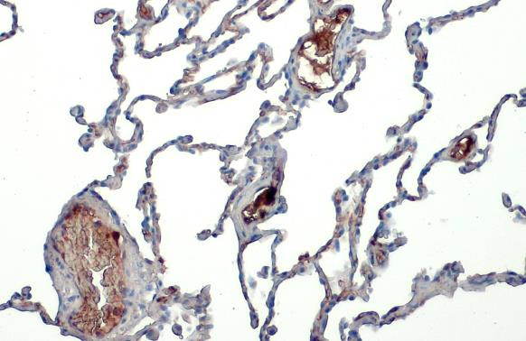 ApoA1 Antibody in Immunohistochemistry (Paraffin) (IHC (P))