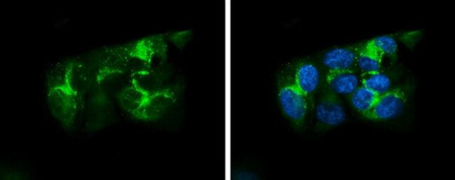 ApoA1 Antibody in Immunocytochemistry (ICC/IF)