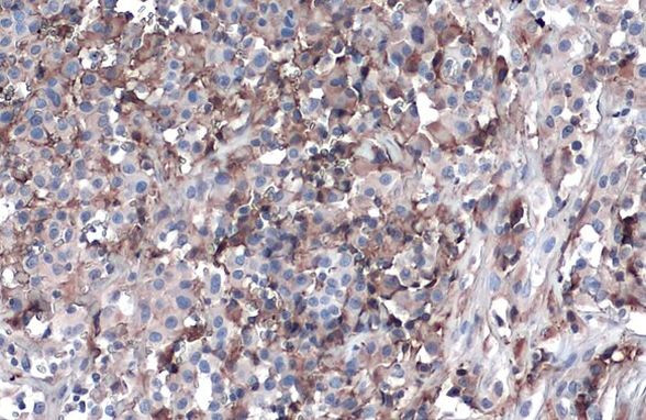 ApoA1 Antibody in Immunohistochemistry (Paraffin) (IHC (P))