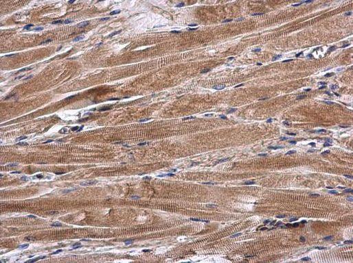 ANP Antibody in Immunohistochemistry (Paraffin) (IHC (P))