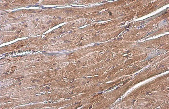 ANP Antibody in Immunohistochemistry (Paraffin) (IHC (P))