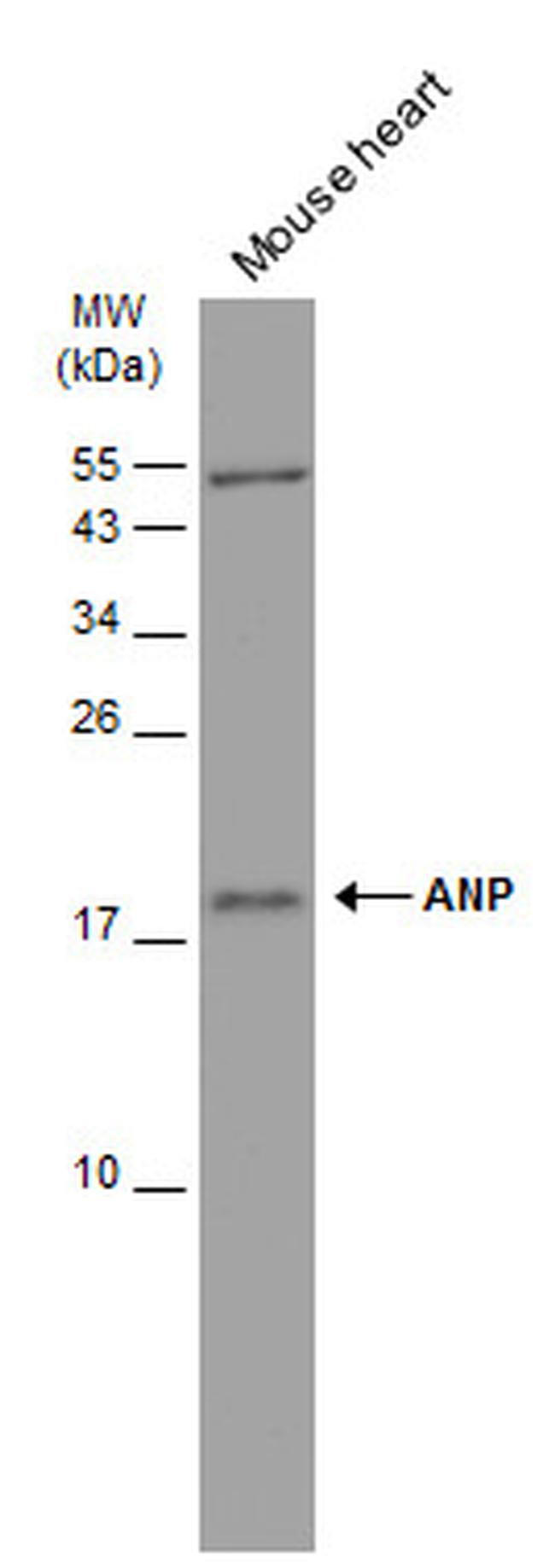 ANP Antibody in Western Blot (WB)