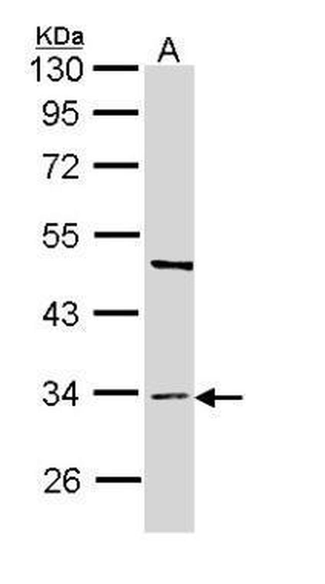 BST-1 Antibody in Western Blot (WB)