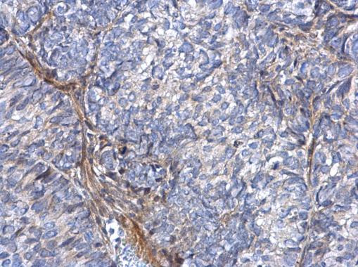 COL1A1 Antibody in Immunohistochemistry (Paraffin) (IHC (P))