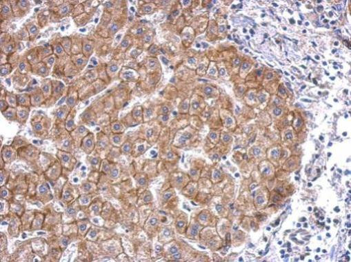 N-cadherin Antibody in Immunohistochemistry (Paraffin) (IHC (P))