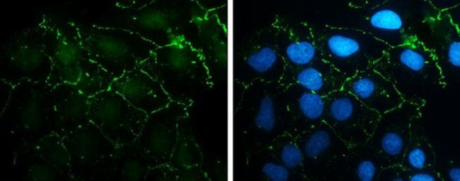 N-cadherin Antibody in Immunocytochemistry (ICC/IF)