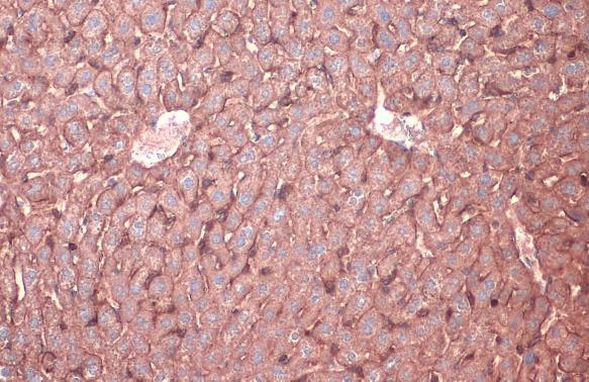 N-cadherin Antibody in Immunohistochemistry (Paraffin) (IHC (P))