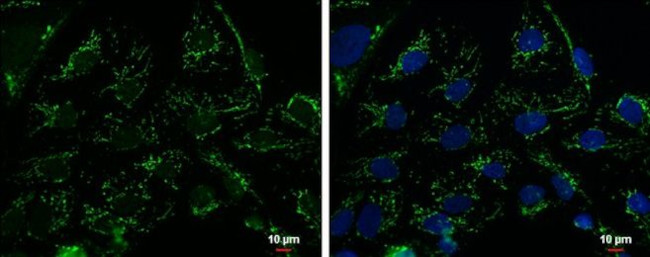 TFAM Antibody in Immunocytochemistry (ICC/IF)