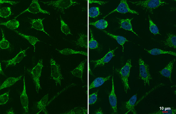 TFAM Antibody in Immunocytochemistry (ICC/IF)