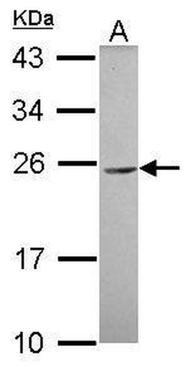 CEACAM3 Antibody in Western Blot (WB)