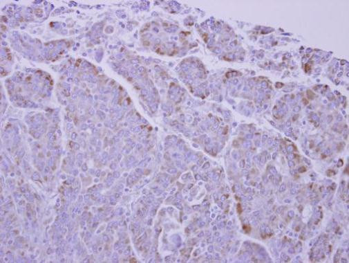 UCP1 Antibody in Immunohistochemistry (Paraffin) (IHC (P))