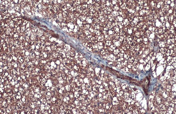 UCP1 Antibody in Immunohistochemistry (Paraffin) (IHC (P))