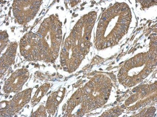 TICAM2 Antibody in Immunohistochemistry (Paraffin) (IHC (P))