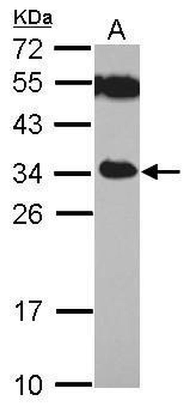 TICAM2 Antibody in Western Blot (WB)