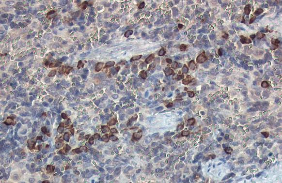 beta-2 Microglobulin Antibody in Immunohistochemistry (Paraffin) (IHC (P))