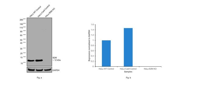 beta-2 Microglobulin Antibody in Western Blot (WB)