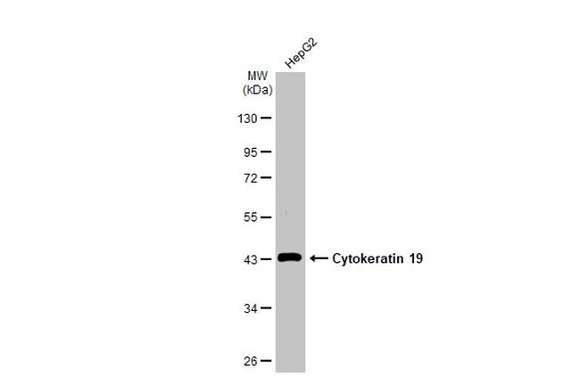 Cytokeratin 19 Antibody in Western Blot (WB)
