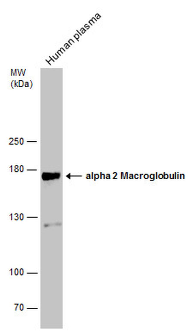 A2M Antibody in Western Blot (WB)