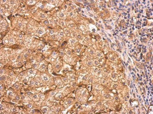 CD36 Antibody in Immunohistochemistry (Paraffin) (IHC (P))