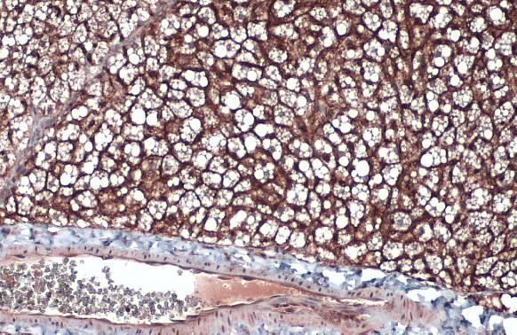 CD36 Antibody in Immunohistochemistry (Paraffin) (IHC (P))