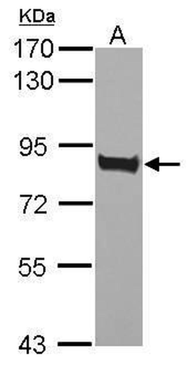 CD36 Antibody in Western Blot (WB)