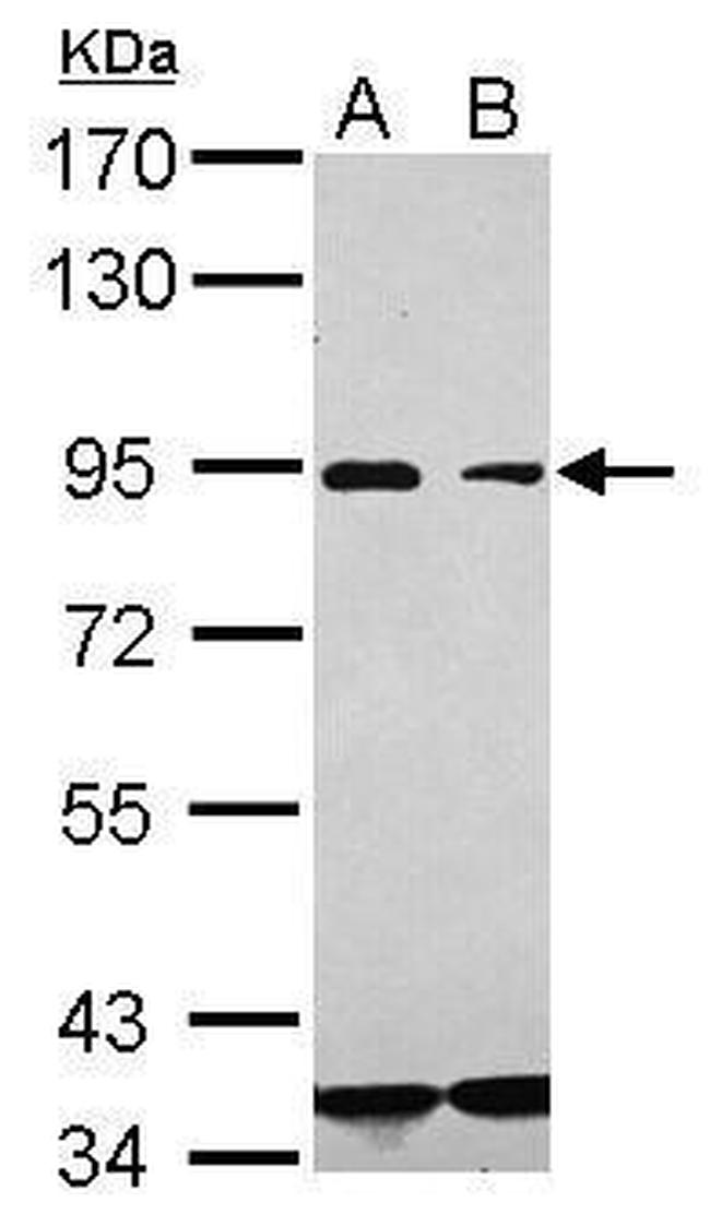 CD36 Antibody in Western Blot (WB)