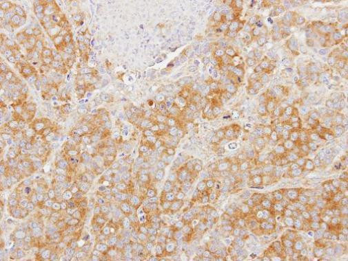 EIF2S1 Antibody in Immunohistochemistry (Paraffin) (IHC (P))