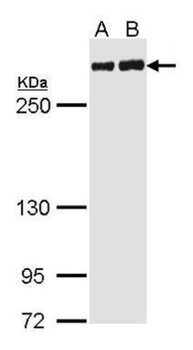 Filamin A alpha-2 Antibody in Western Blot (WB)