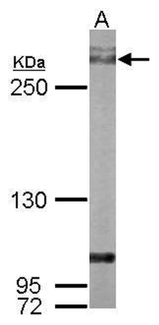 Filamin A alpha-2 Antibody in Western Blot (WB)