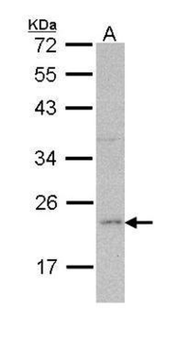 Ferritin Light Chain Antibody in Western Blot (WB)