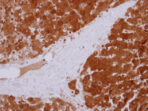 GPT Antibody in Immunohistochemistry (Paraffin) (IHC (P))