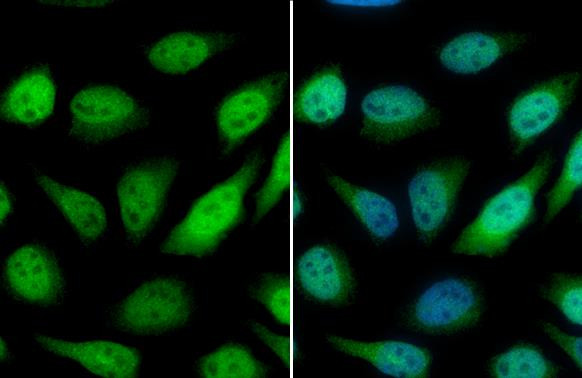 GSTP1 Antibody in Immunocytochemistry (ICC/IF)