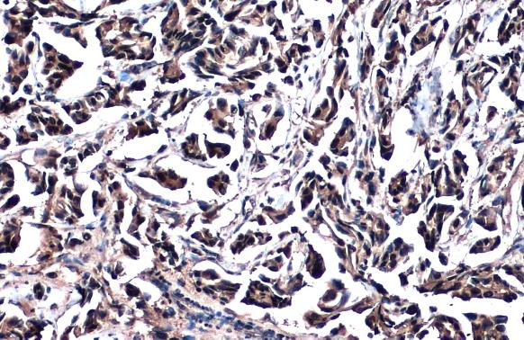 GSTP1 Antibody in Immunohistochemistry (Paraffin) (IHC (P))