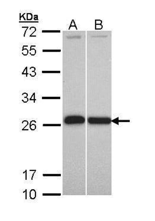 GSTP1 Antibody in Western Blot (WB)