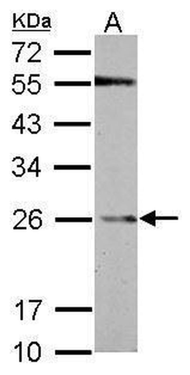 GSTP1 Antibody in Western Blot (WB)