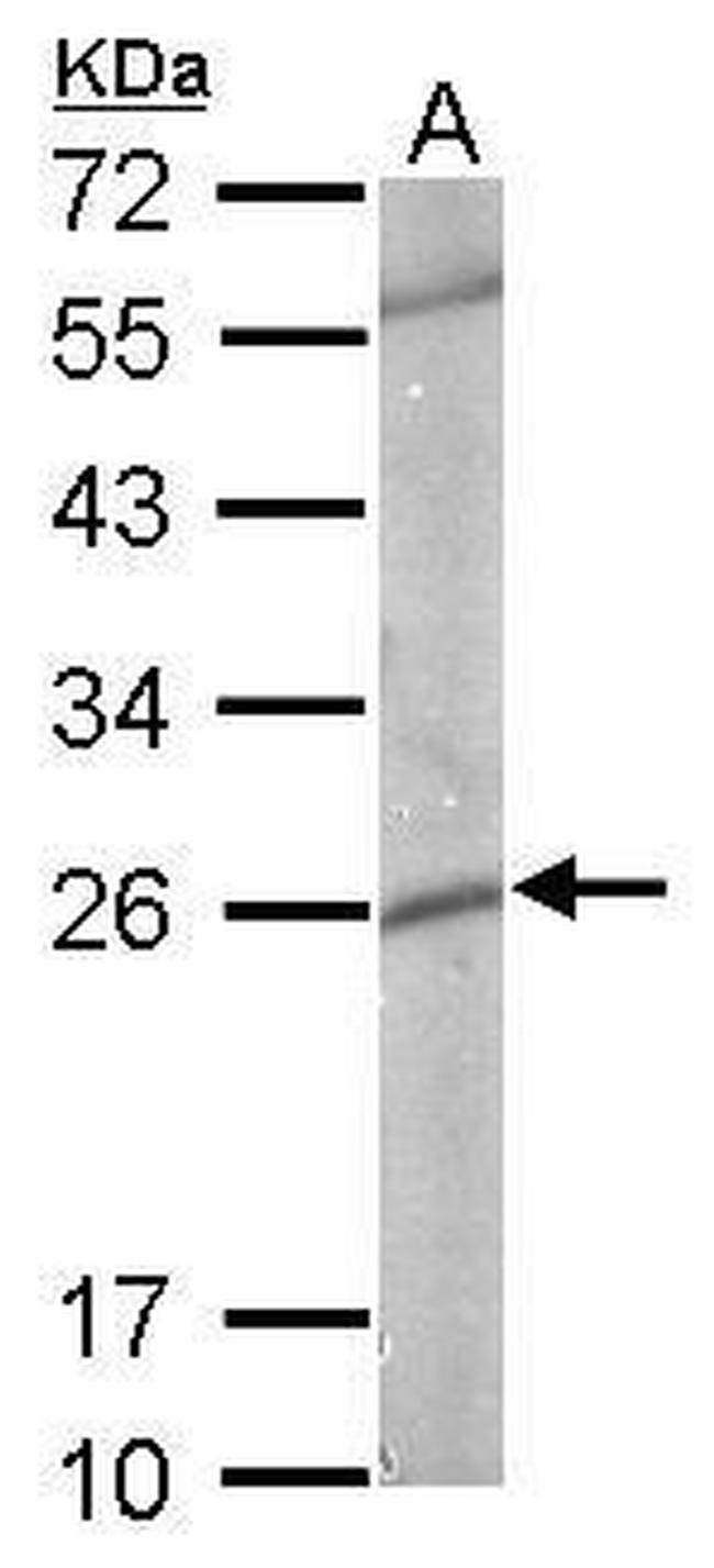 GSTP1 Antibody in Western Blot (WB)