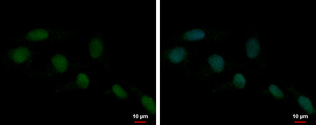 HMGB1 Antibody in Immunocytochemistry (ICC/IF)