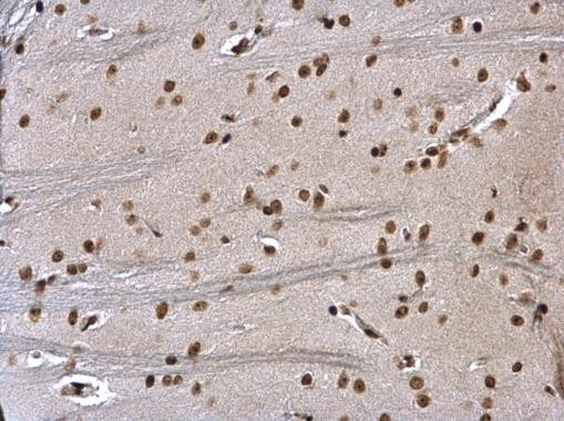 HMGB1 Antibody in Immunohistochemistry (Paraffin) (IHC (P))