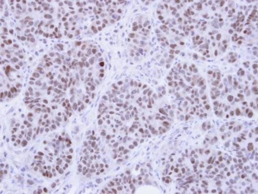 HMGB1 Antibody in Immunohistochemistry (Paraffin) (IHC (P))