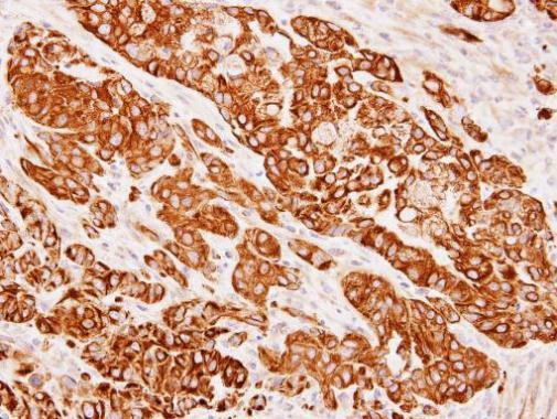 Cytokeratin 8 Antibody in Immunohistochemistry (Paraffin) (IHC (P))