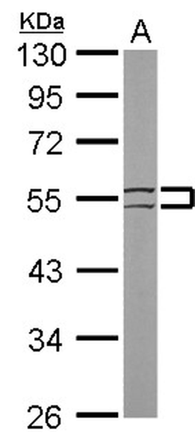 Cytokeratin 8 Antibody in Western Blot (WB)