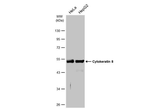 Cytokeratin 8 Antibody in Western Blot (WB)