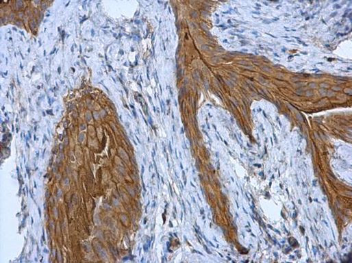 Cytokeratin 18 Antibody in Immunohistochemistry (Paraffin) (IHC (P))