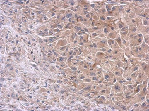 PI3K p85 alpha Antibody in Immunohistochemistry (Paraffin) (IHC (P))