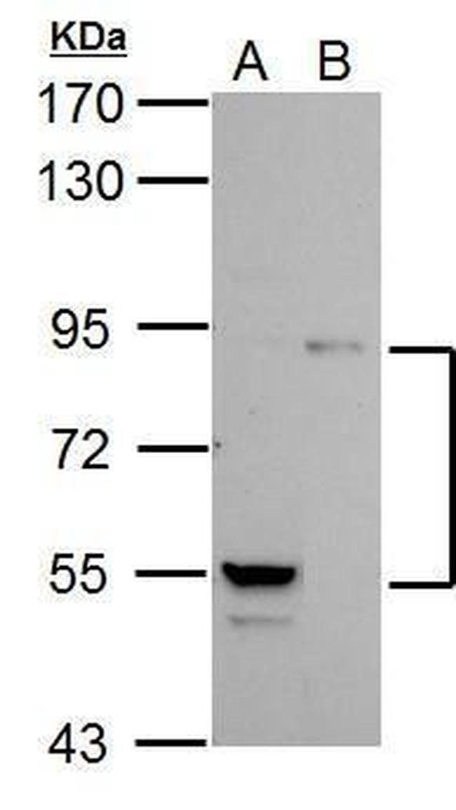 PI3K p85 alpha Antibody in Western Blot (WB)