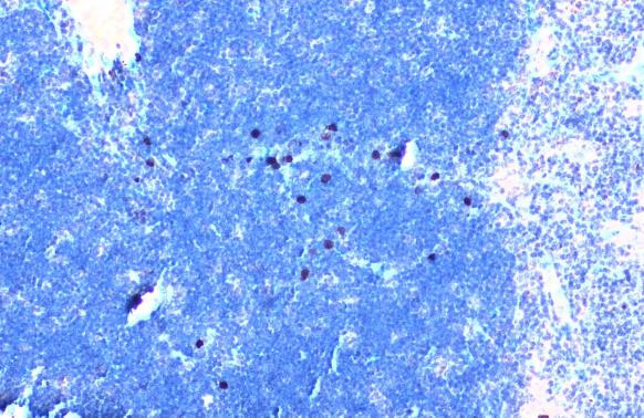 TLR3 Antibody in Immunohistochemistry (Paraffin) (IHC (P))