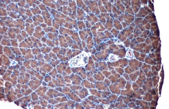 TLR3 Antibody in Immunohistochemistry (Paraffin) (IHC (P))