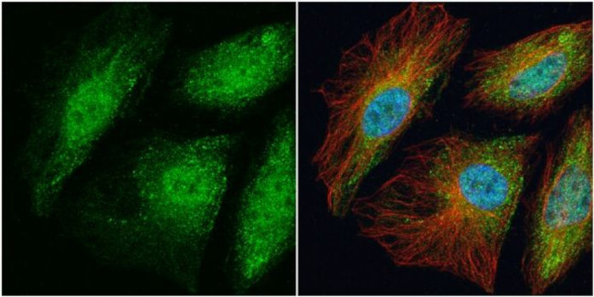 TRAF6 Antibody in Immunocytochemistry (ICC/IF)